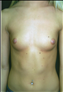 24771-80136b_thumb