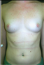 24781-80166b_thumb